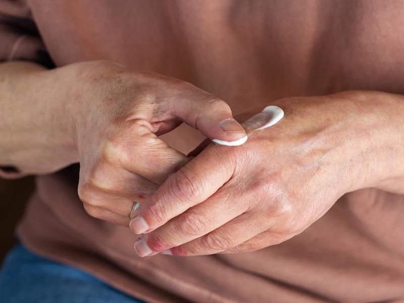 Hiện chưa có vaccine phòng bệnh viêm da cơ địa