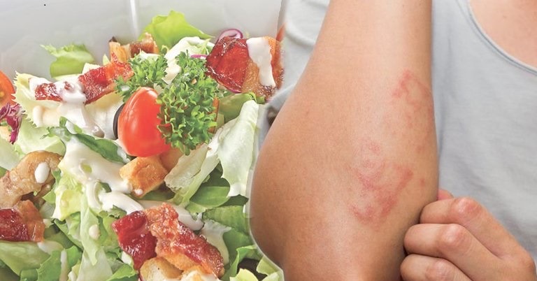 thực phẩm nên ăn khi bị viêm da