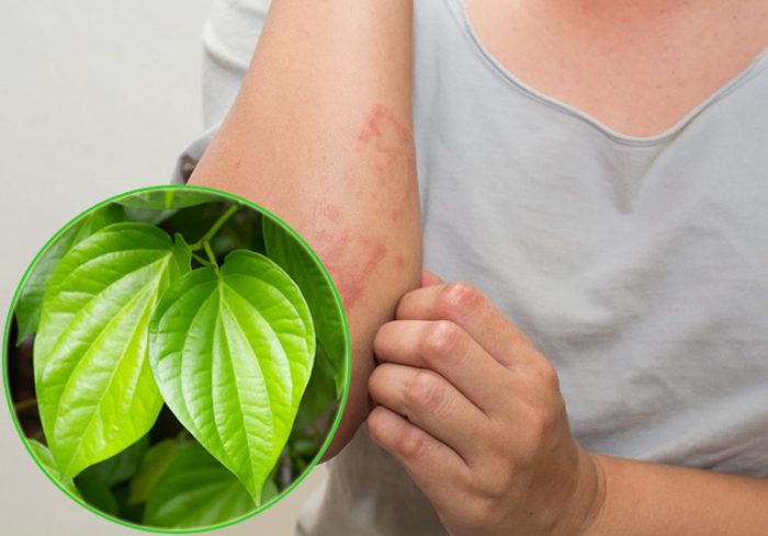 lá trầu không điều trị viêm da dị ứng