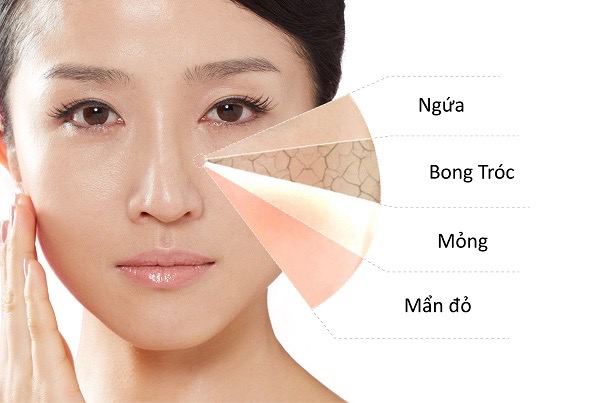 dấu hiệu viêm da mặt