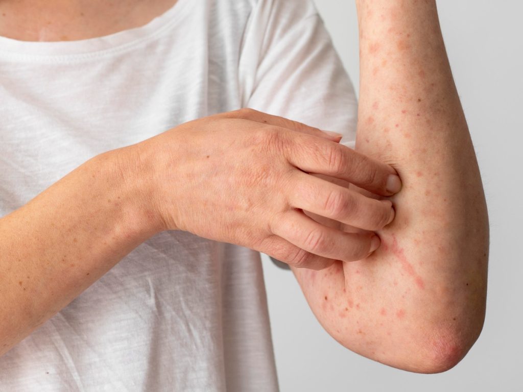 da tay bị ngứa nổi mẩn đỏ