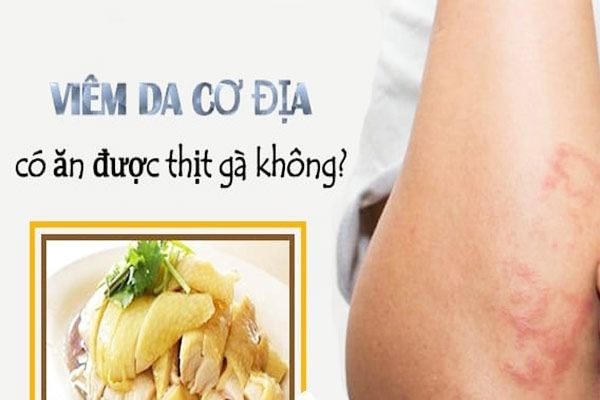 1. Tổng quan về viêm da cơ địa